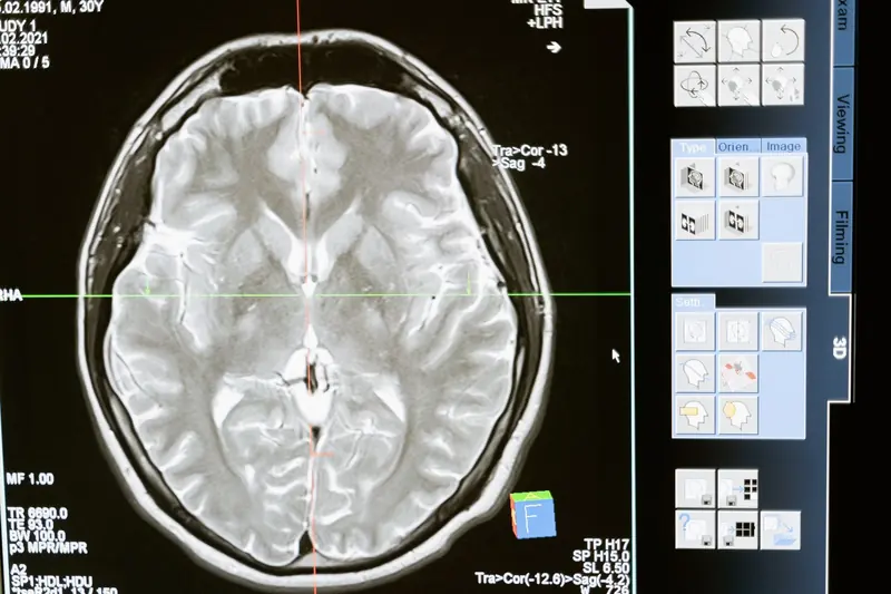 Axial brain MRI on a PACS workstation